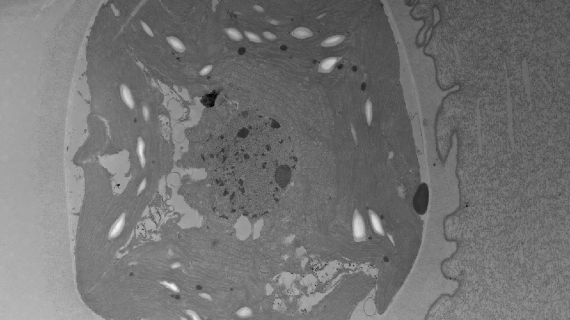 TEM microscopic image of Salamander Algae Capsule Wall