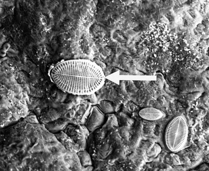 Microscopic image of seaweed